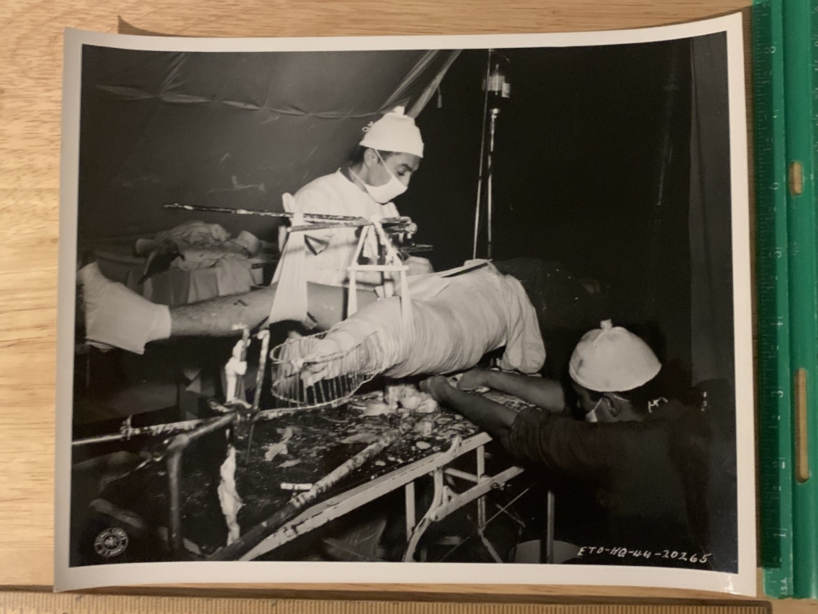 WW2 U.S. Army Signal Corps Photograph Doctor / Surgical Amputation Lost Limb