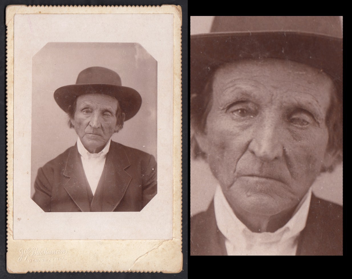 ONE-EYE BLIND OLD STOIC WISE MAN STARES YOU DOWN ~ 1800s CABINET PHOTO